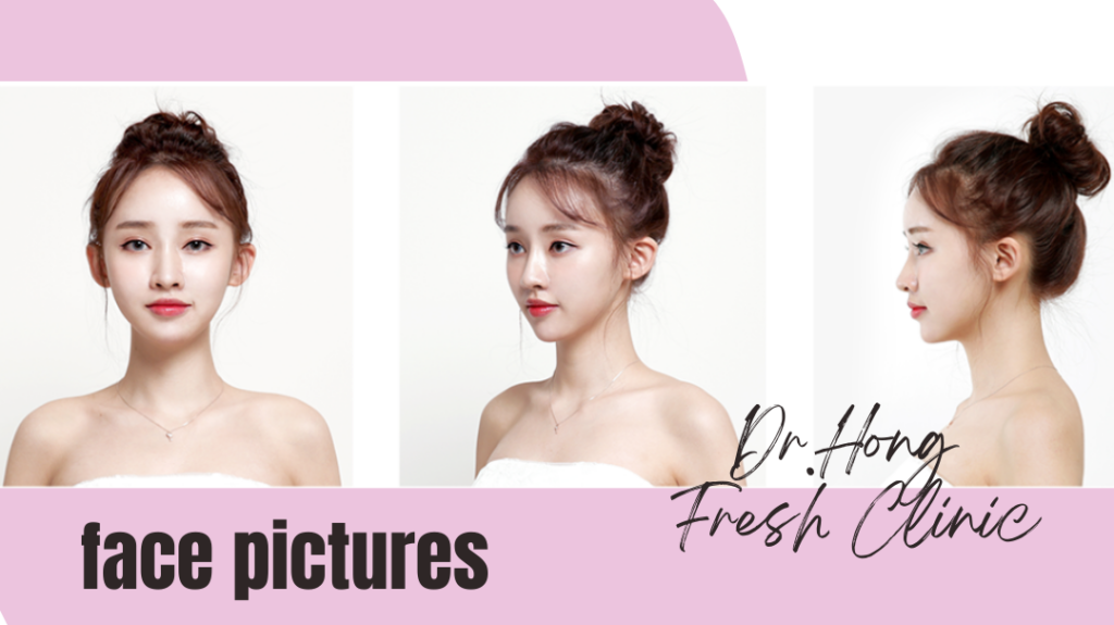 What to Check Before Plastic Surgery: guideline how  to take picture for online consultation : on photo there is one woman with bun and open shoulders top in 3 body positions : front , 45 degree, side view 