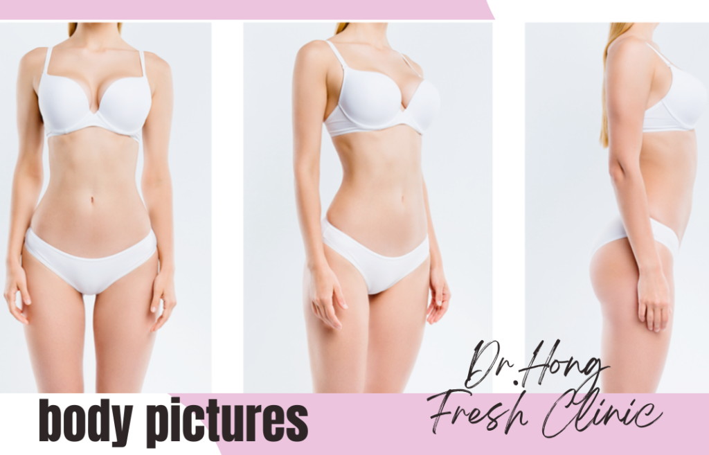 What to Check Before Plastic Surgery: guideline how  to take picture for online consultation for body part . on photo there is one woman wearing white color inner wear (bra and pantie) in front , 45 degree and side view position. 