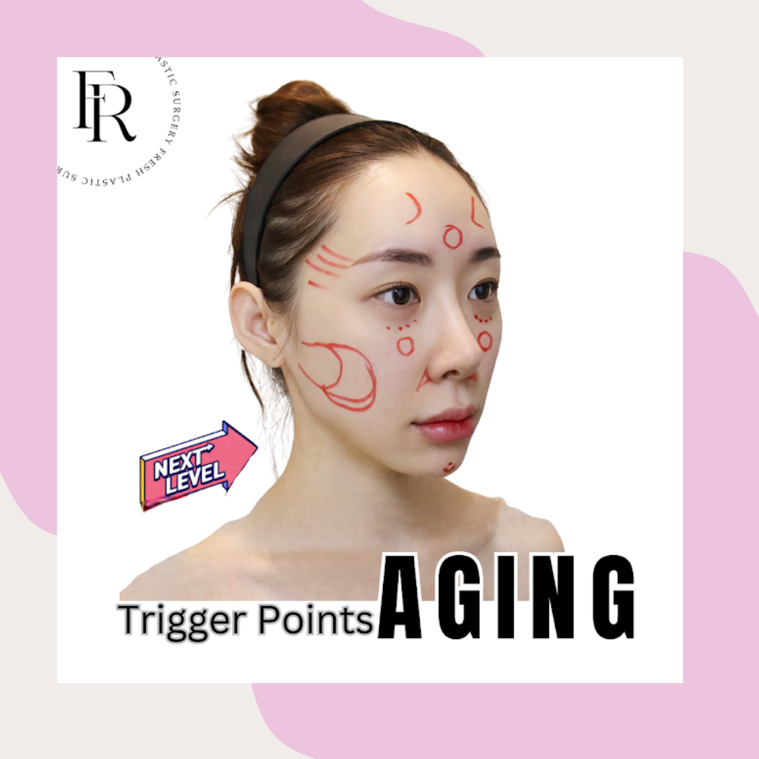 Asian young woman with bun hairstyle, turned 45 degree. O her face there is some marks was made for facial fat transfer treatment pre-op design 
