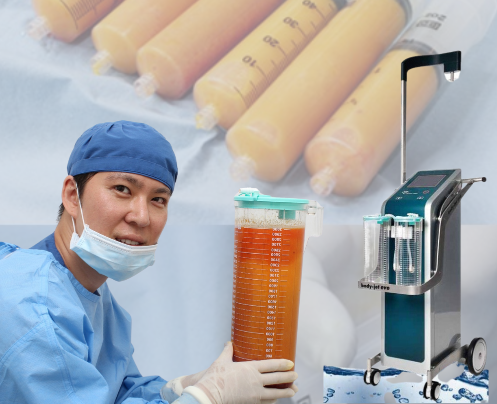 on the back ground of fat filled syringes, there is Asian man -dr. Hong wearing surgical mask, cap and gown  and holding full fat  filled plastic bucked in his hands. on the right side there is machine he used for harvesting this fat for fat transfer treatment and transfer it to breast 