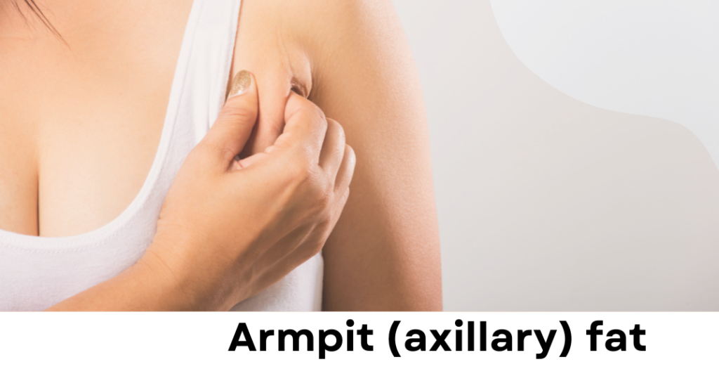 Armpit liposuction area : axillary fat  (located near breast and looks like small rolls) is pinched by woman's hand wearing white  sleeveless top. 