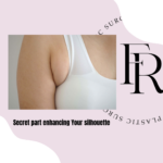 breast fat transfer & armpit liposuction in Fresh Clinic before and after photo : there are 2 woman upper body pictures on the top, showing front view of breast and underarms condition before treatment and after.
